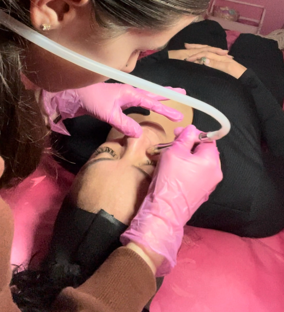 Microdermabrasion Facial
