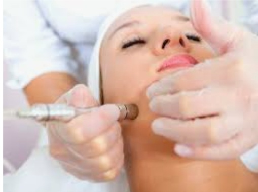 Microdermabrasion