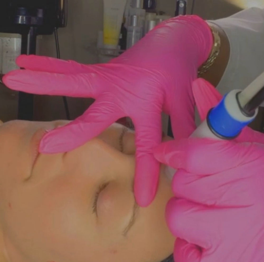 Microdermabrasion Facial at Skinsational Beauty Boutique in Bethany, OK