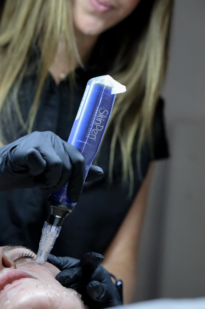 HYDRANEEDLE RENEWAL