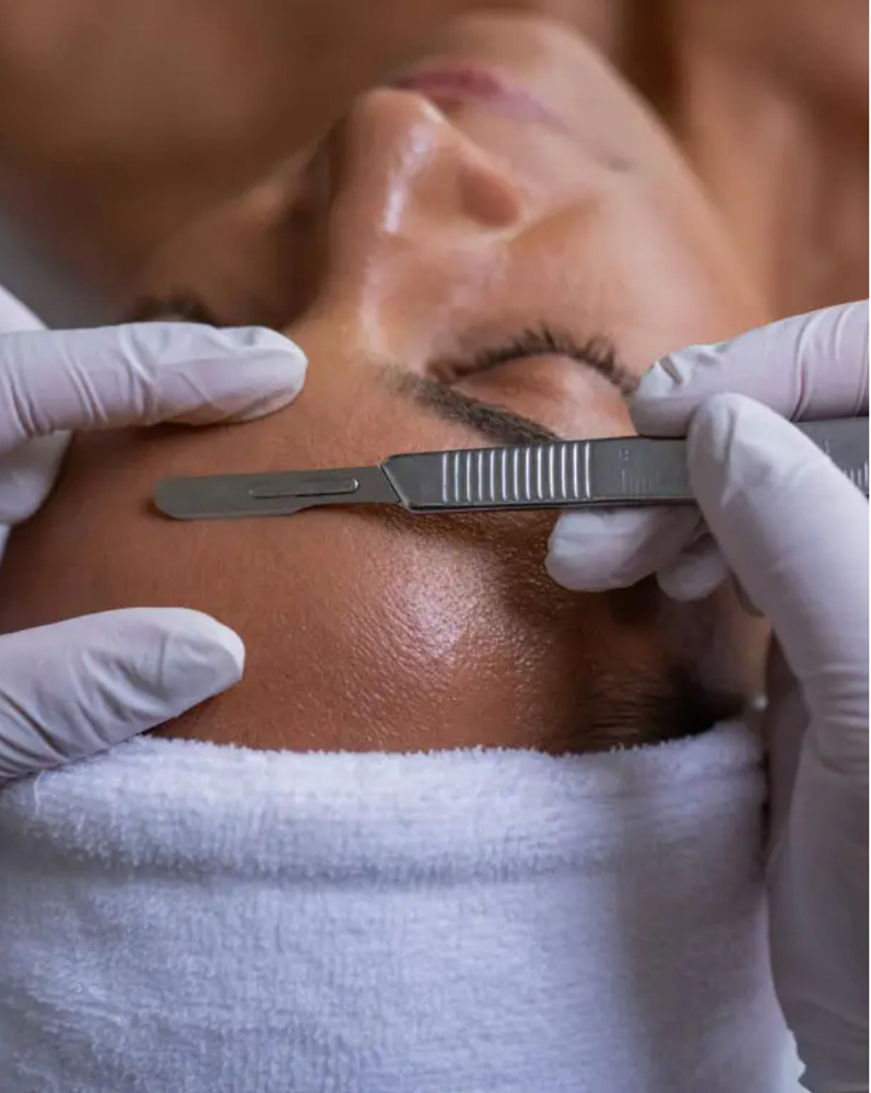 Dermaplaning