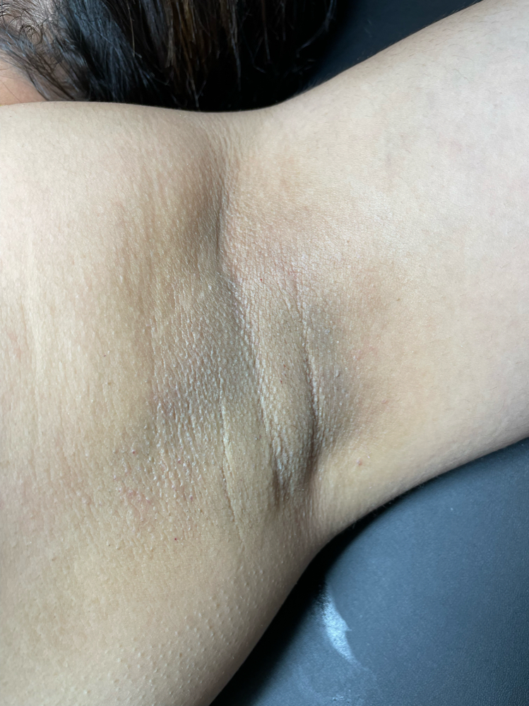 Underarm Wax