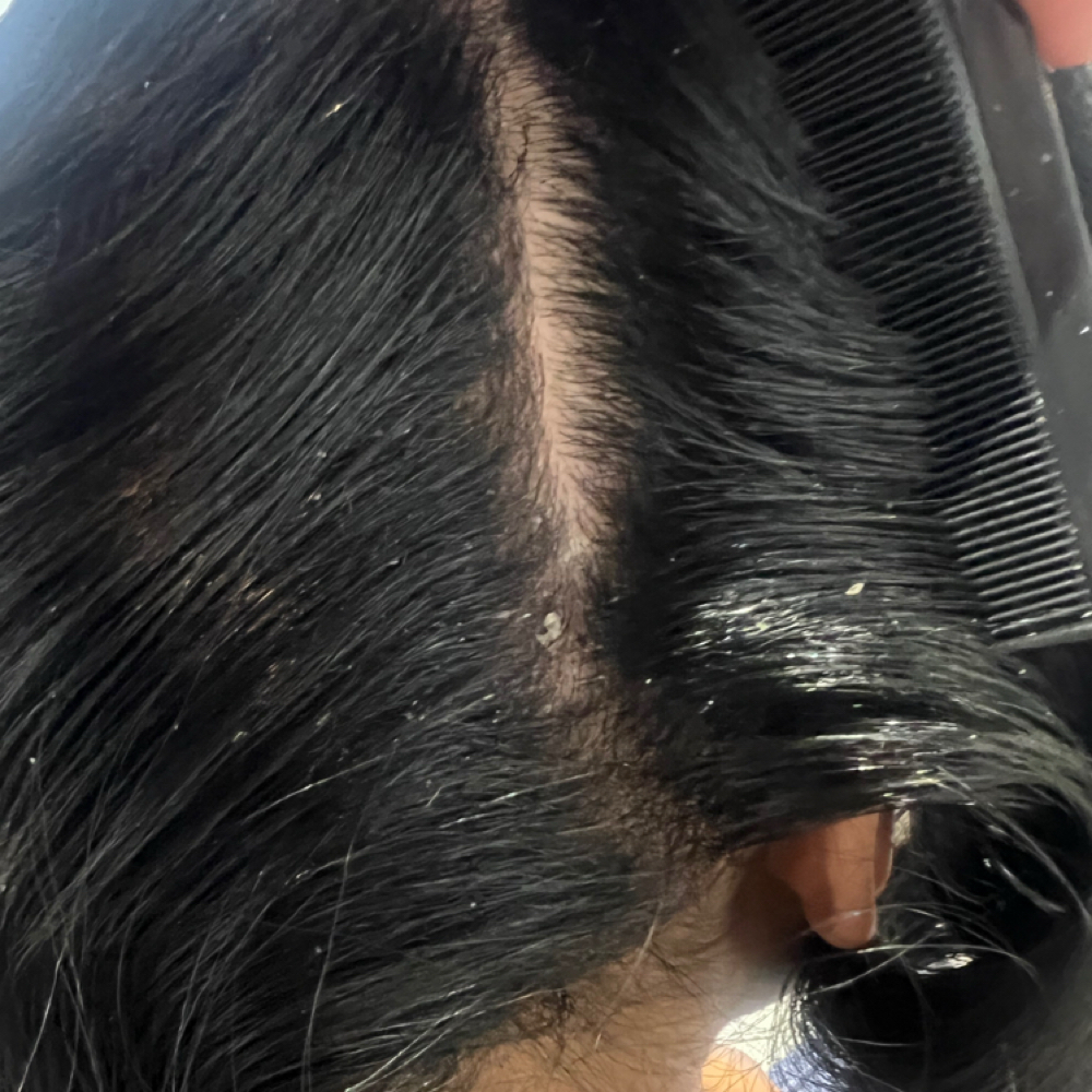 Scalp Detox at Karlika Kimora in Henderson, NV
