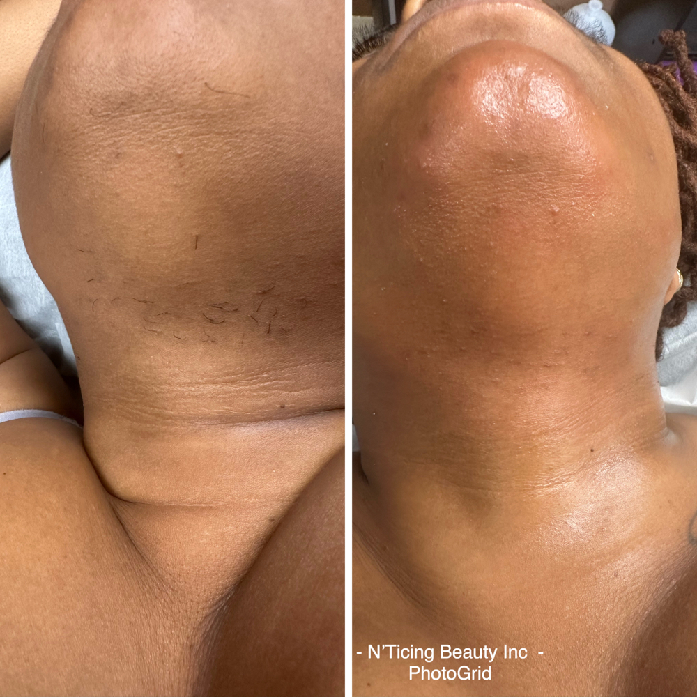 Chin Wax