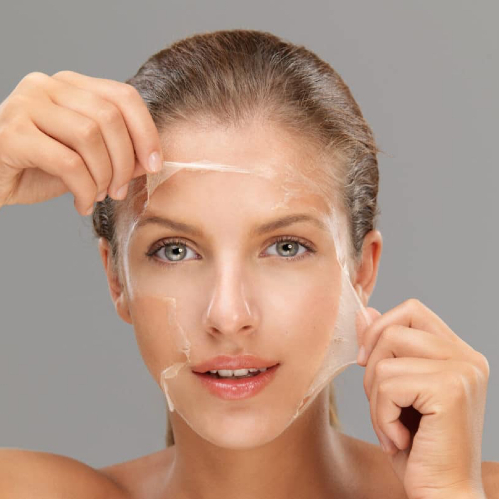 Chemical Peel at Aesthetics by Alli in Eagle, ID