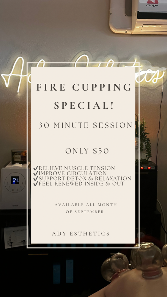 Cupping Therapy Special