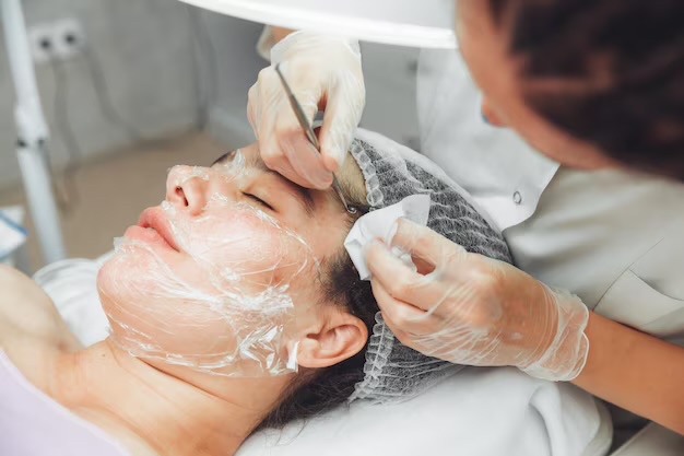 Acne Facial
