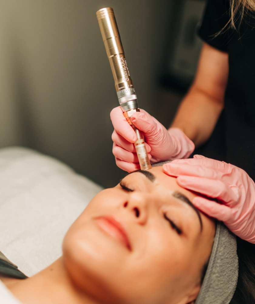 Microneedling Neck Add-On