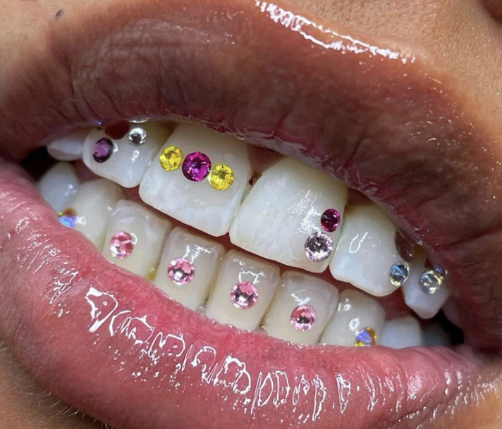 Temporary Tooth Gems