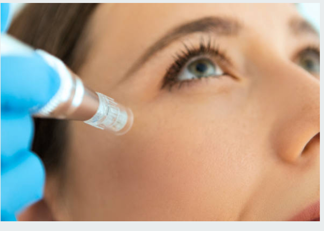 October Special Skinpen at Le Reve in Fort worth, TX