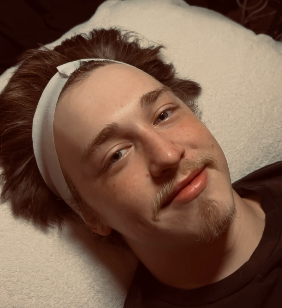 Diamond Glow Microderm