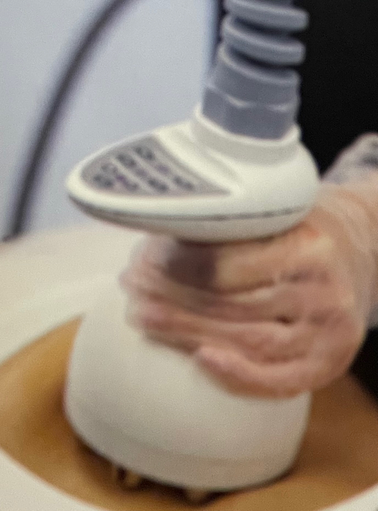 VariPulse/ 1 Treatment