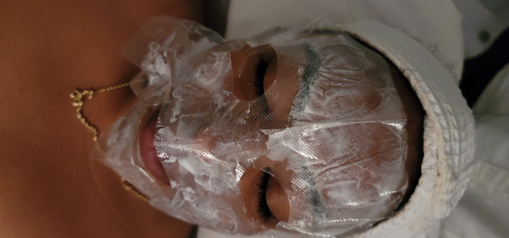 Microneedling Facial