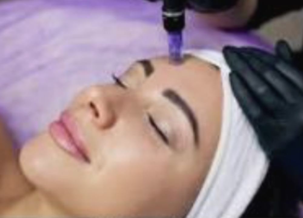 3 Microneedling areas/sessions at your skin sanctuary LLC in Peoria, AZ