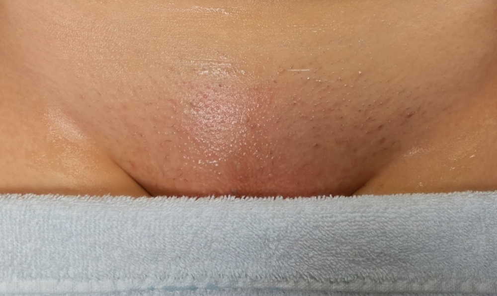 Intimate Waxing Services at Glow Loft in North Haven, CT
