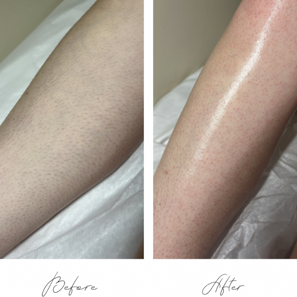 Lower Leg Wax at In His Image Esthetics in Lincolnton, NC