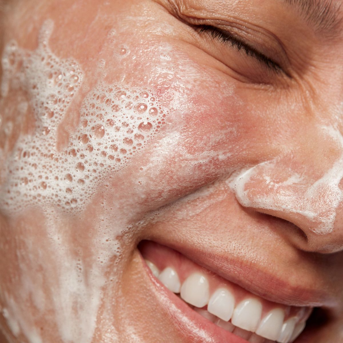 Glow & Go Acne Facial