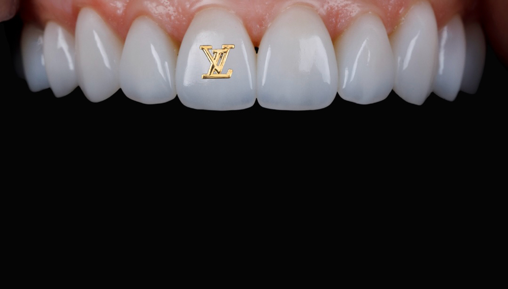 18k Gold Designer Charm