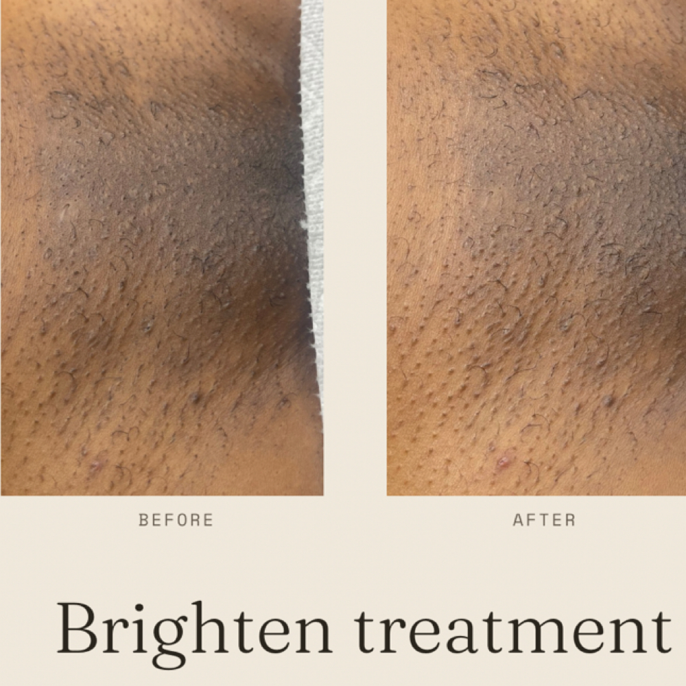 Bright Honey Treatment at Honey Cove in Allen Park, MI