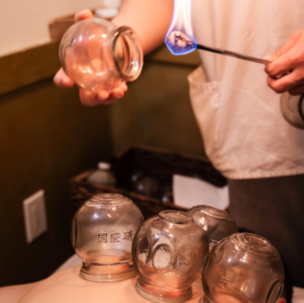 Cupping at RS Head Spa & Body Massage in Seattle, WA