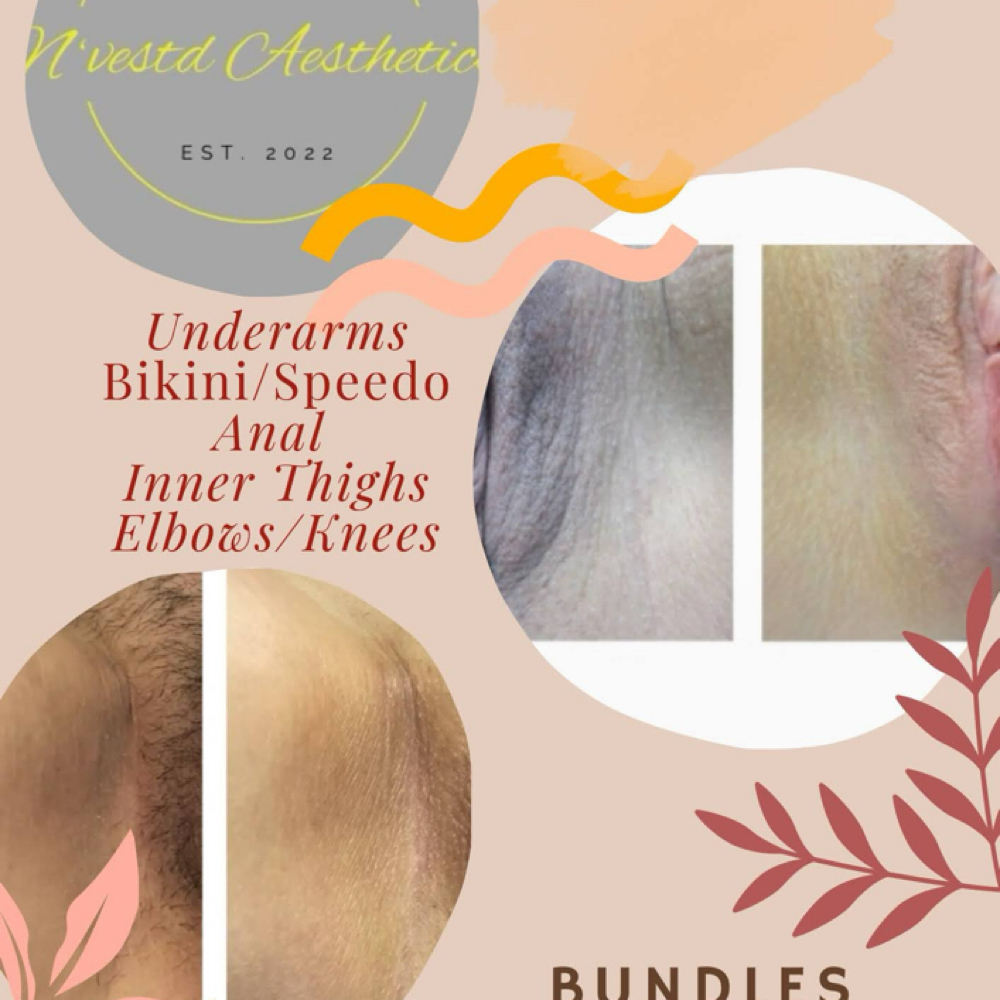 Intimate Lightening (Peach Polish) at N'Vestd Aesthetics in Fairfeild, OH