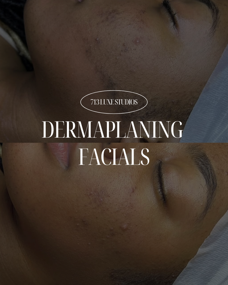 Dermaplaning Facial For 2