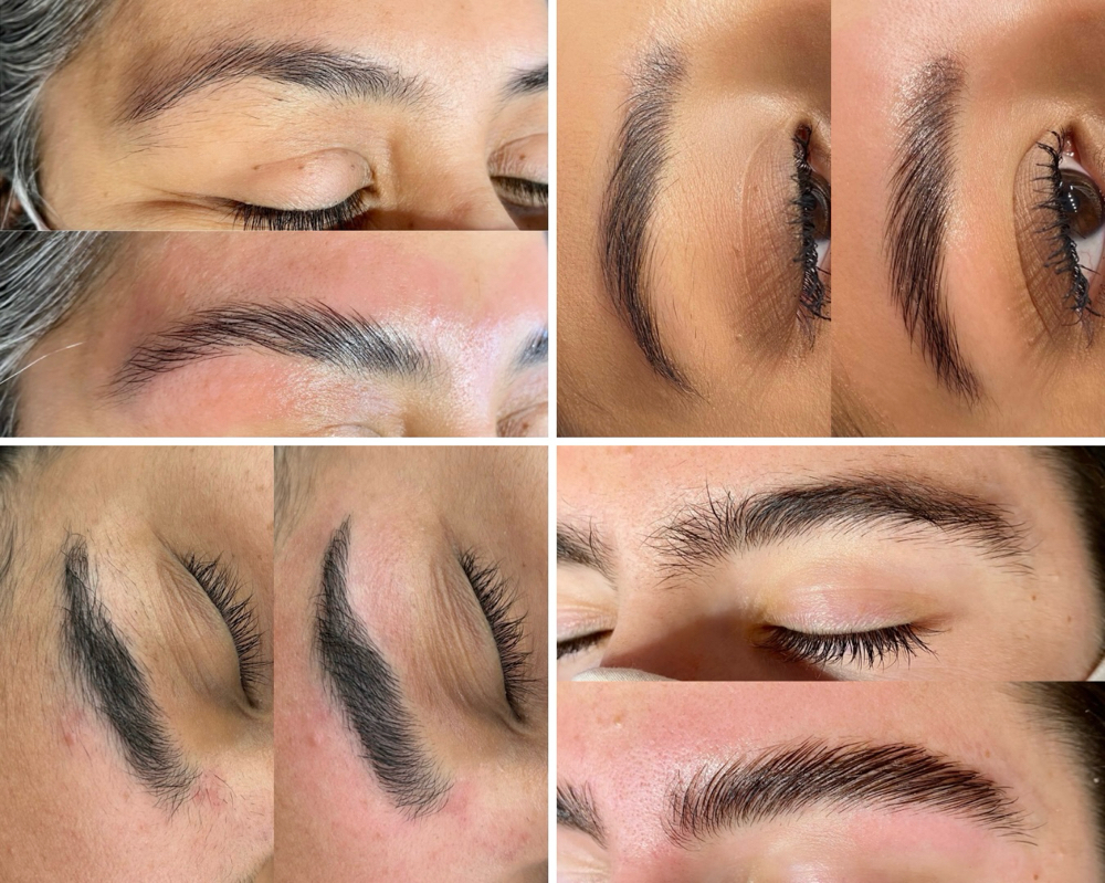 Brow Therapy