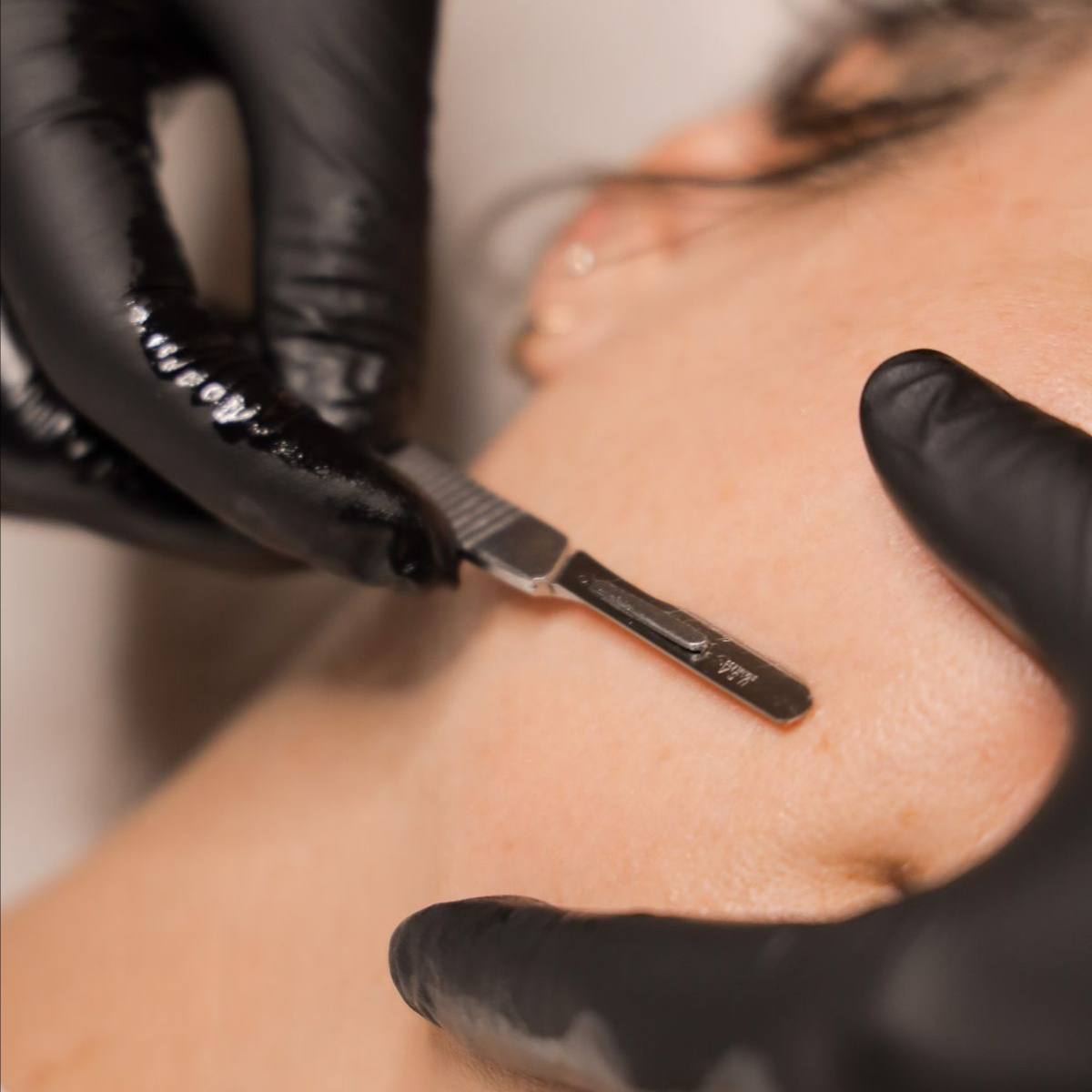 Advanced Custom Facial at Lily Ruth Esthetics in New Berlin, WI