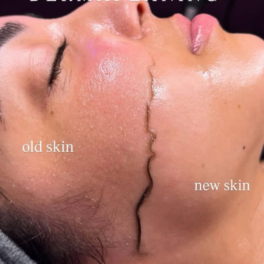 Dermaplaning Facial at Lashes in 1 Hour Natural & Volume in Palo Alto, CA