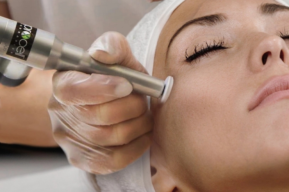 Microchanneling-micro-needling