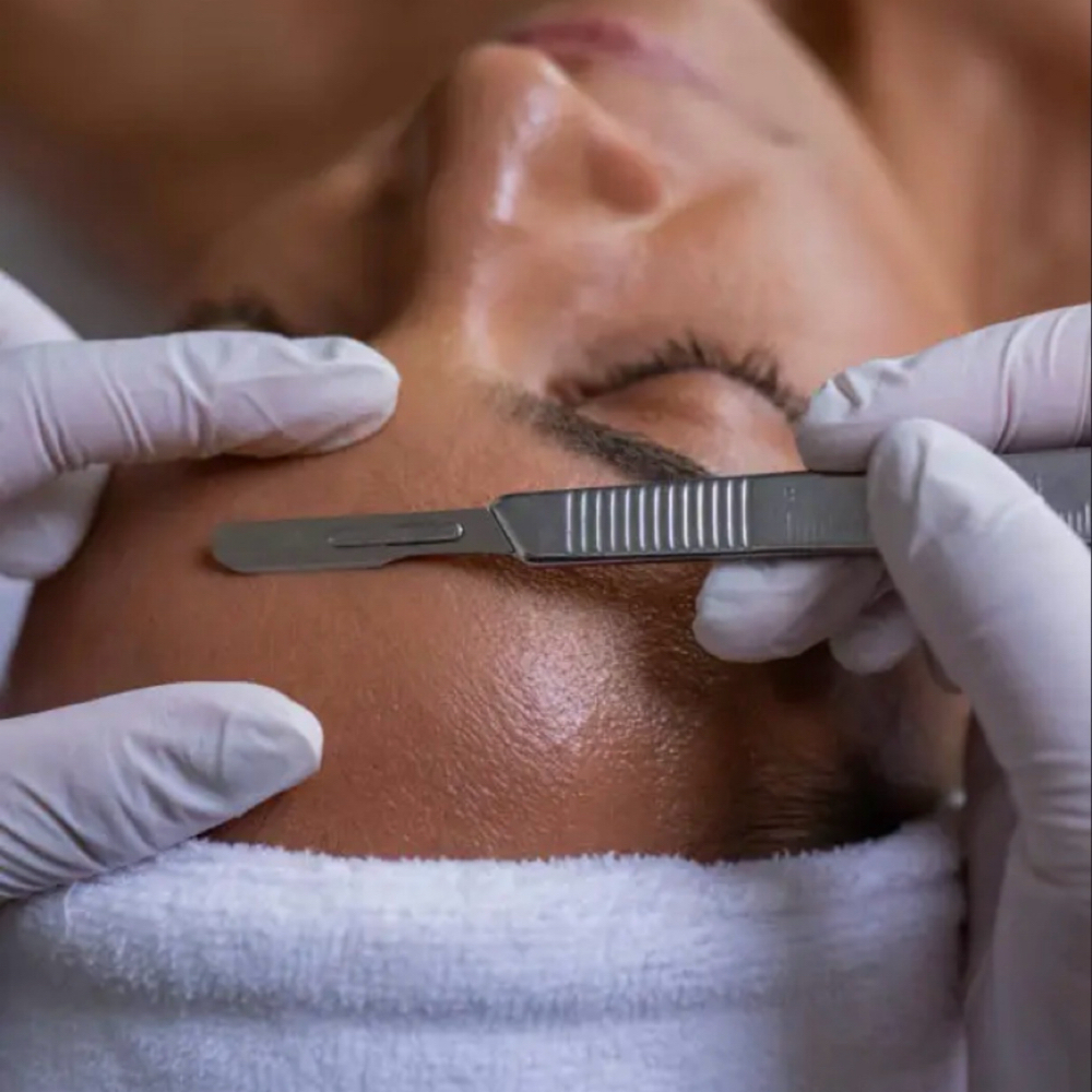 ✨Dermaplane Glow Facial at Allure Skin & Wellness LLC in Valparaiso, IN