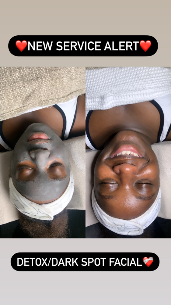 Detox/Dark Spot Treatment