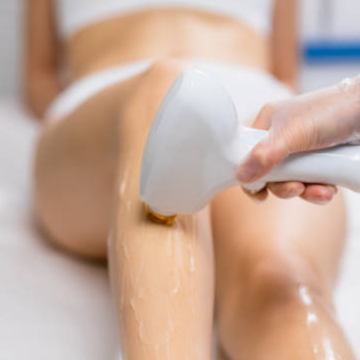 Laser Hair Removal - Medium Area at 360 Med Spa Buford in Buford, GA