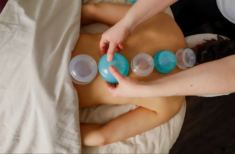 Cupping