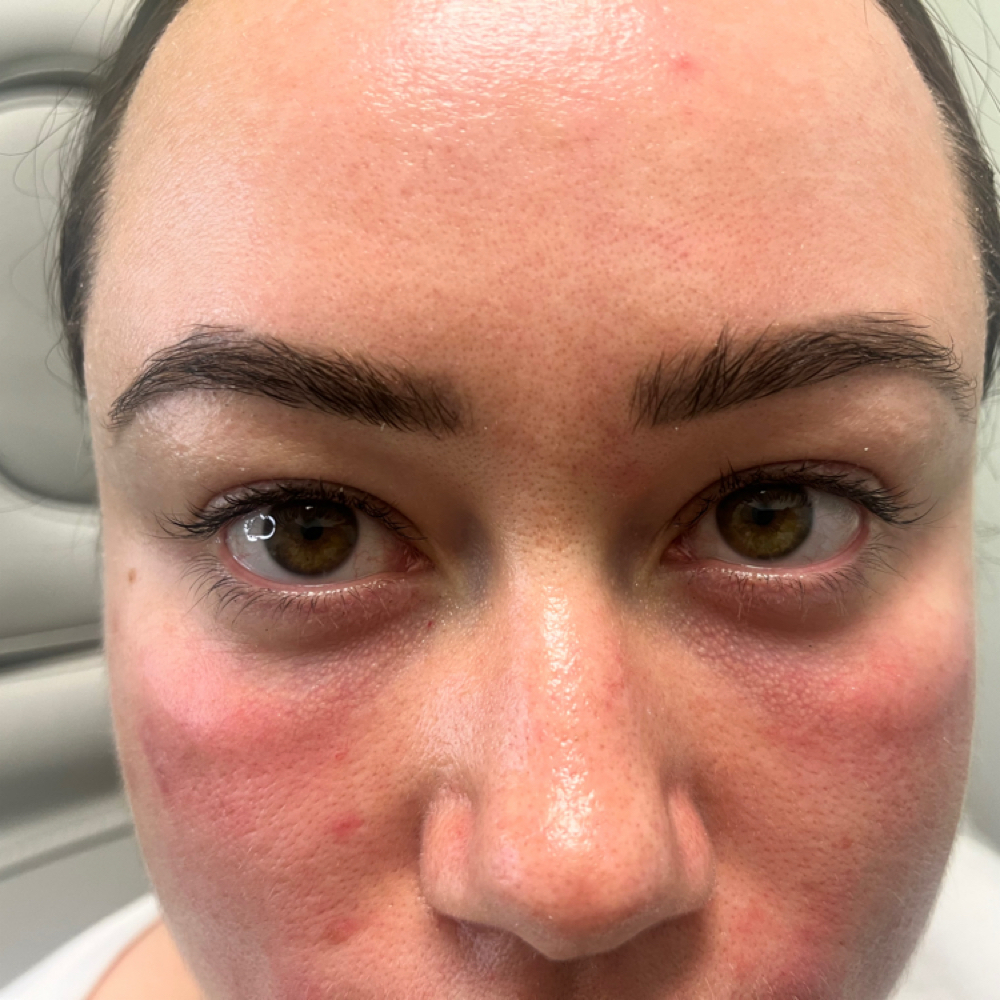 PRF EZGel at Genesis Health and Beauty Bar in Daphne, AL