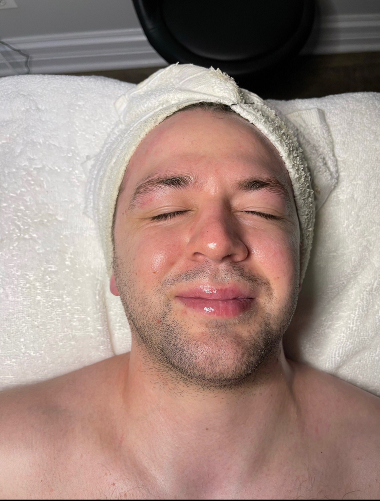 Custom Peel