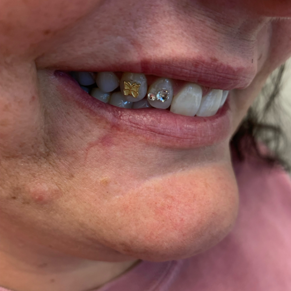 Gold Tooth Gem at Onyx Beauty in Chesapeake, VA