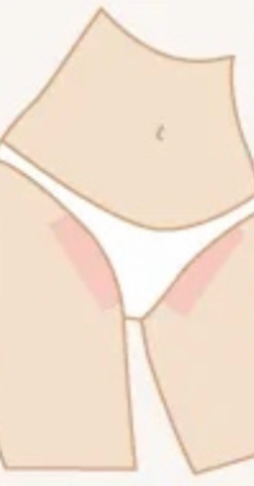 Bikini (Vulva)