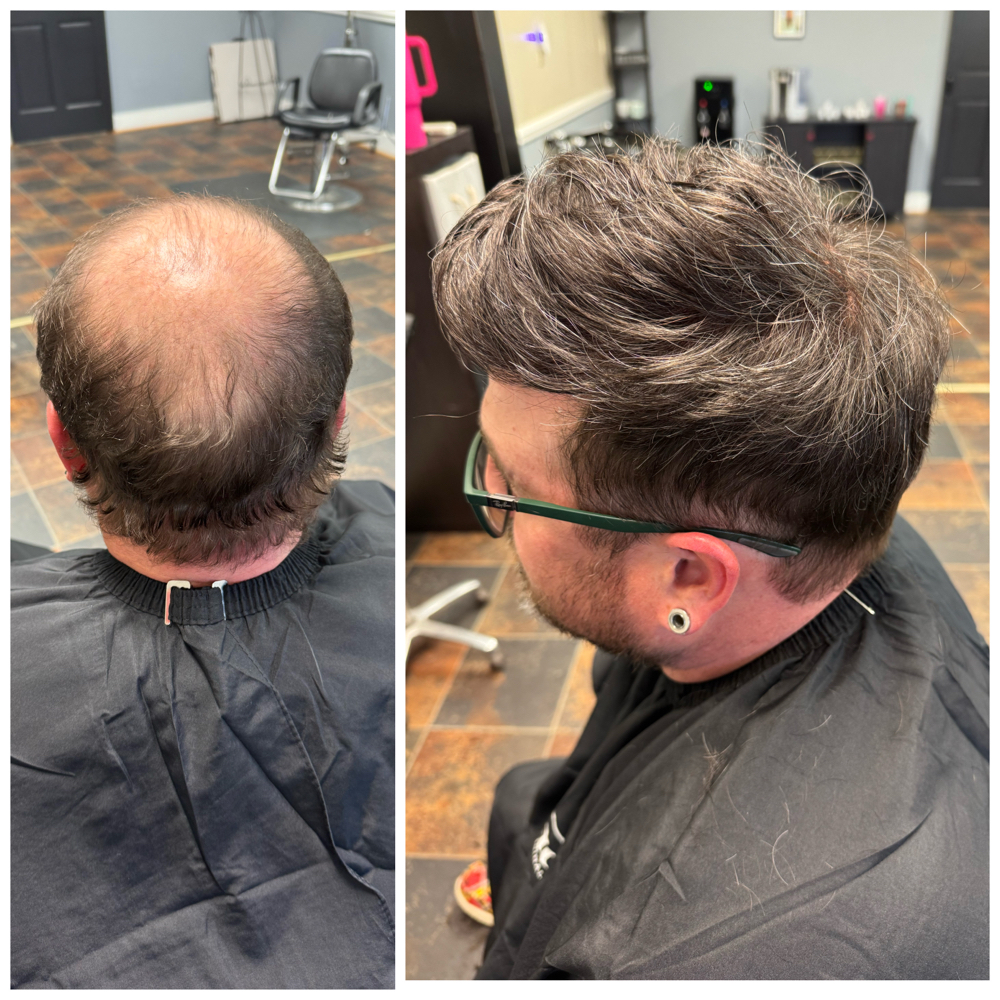 Non-Surgical Hair Grafting at The Rose Salon & Extensions in Stanley, NC