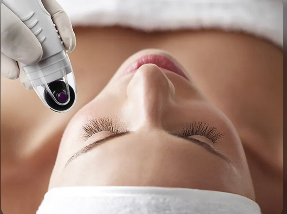 Dermafract- Microneedling/Infusion