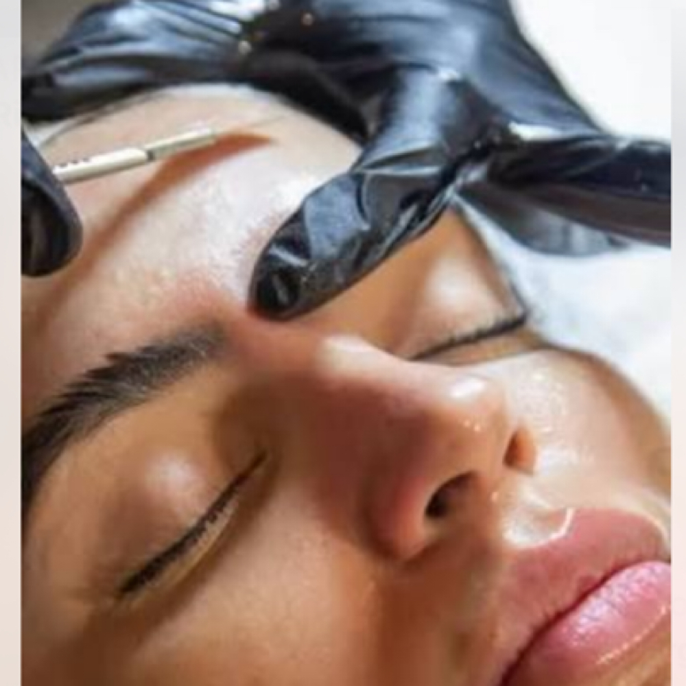 Dermaplaning at Esthetics With Michaela in Vidalia, LA