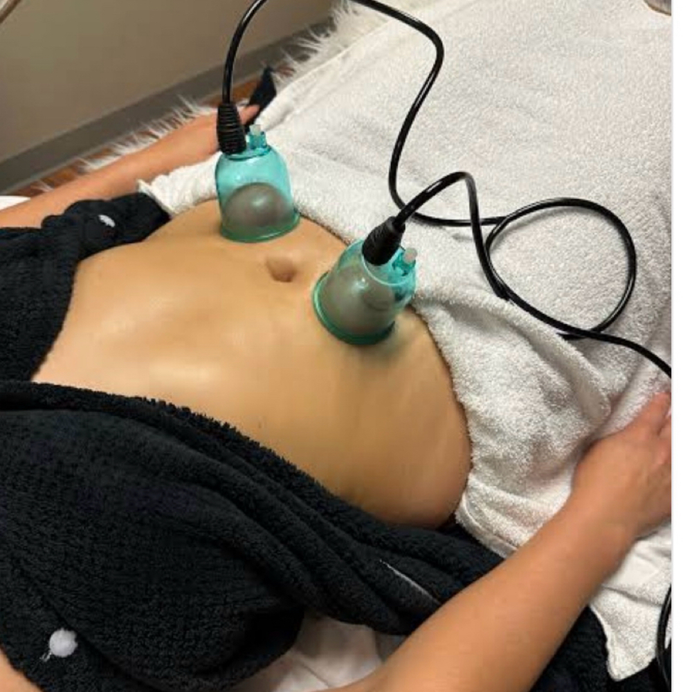 Body Contouring And Cupping Treatme at Magnolia Island Skin Care in Robert, LA