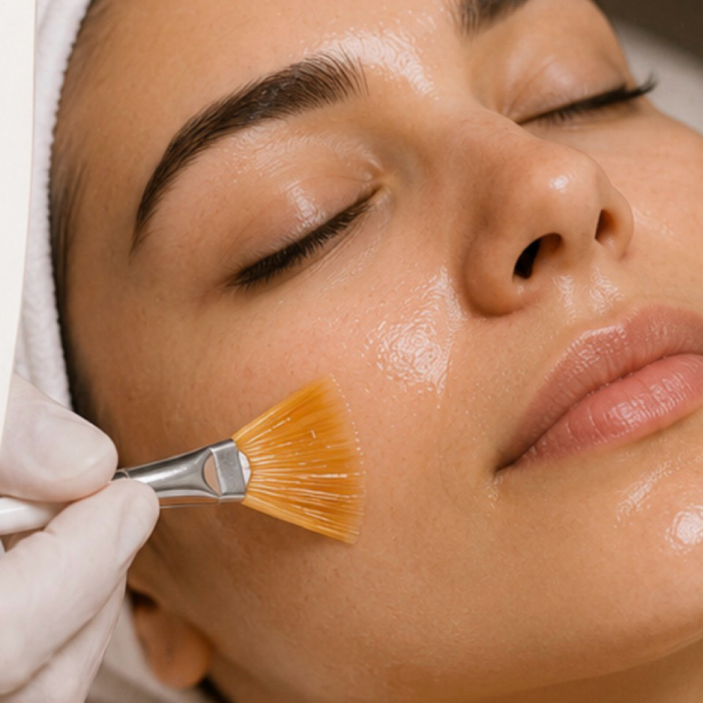 Chemical Peel at Beautywithkb in Upland, CA
