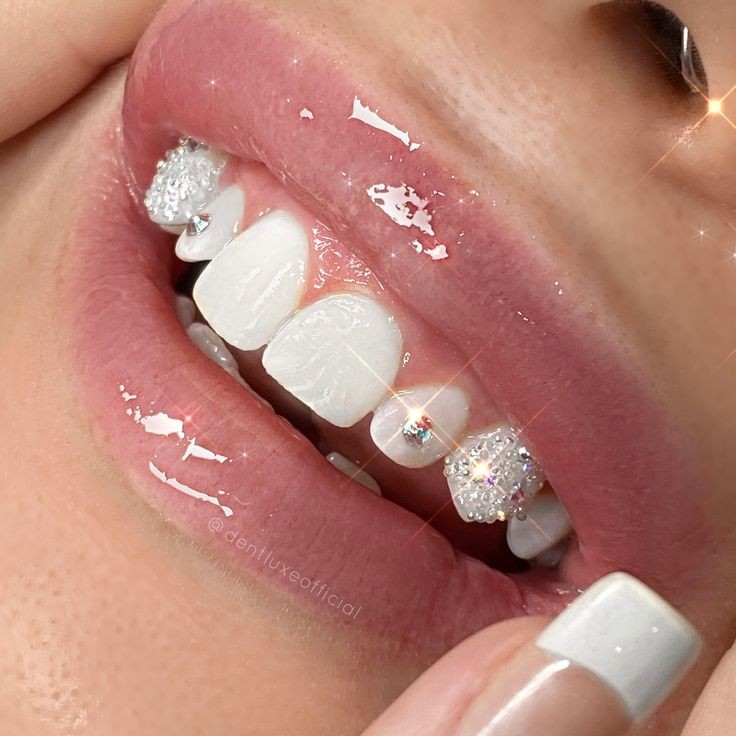 TOOTH DRIP ✨💎