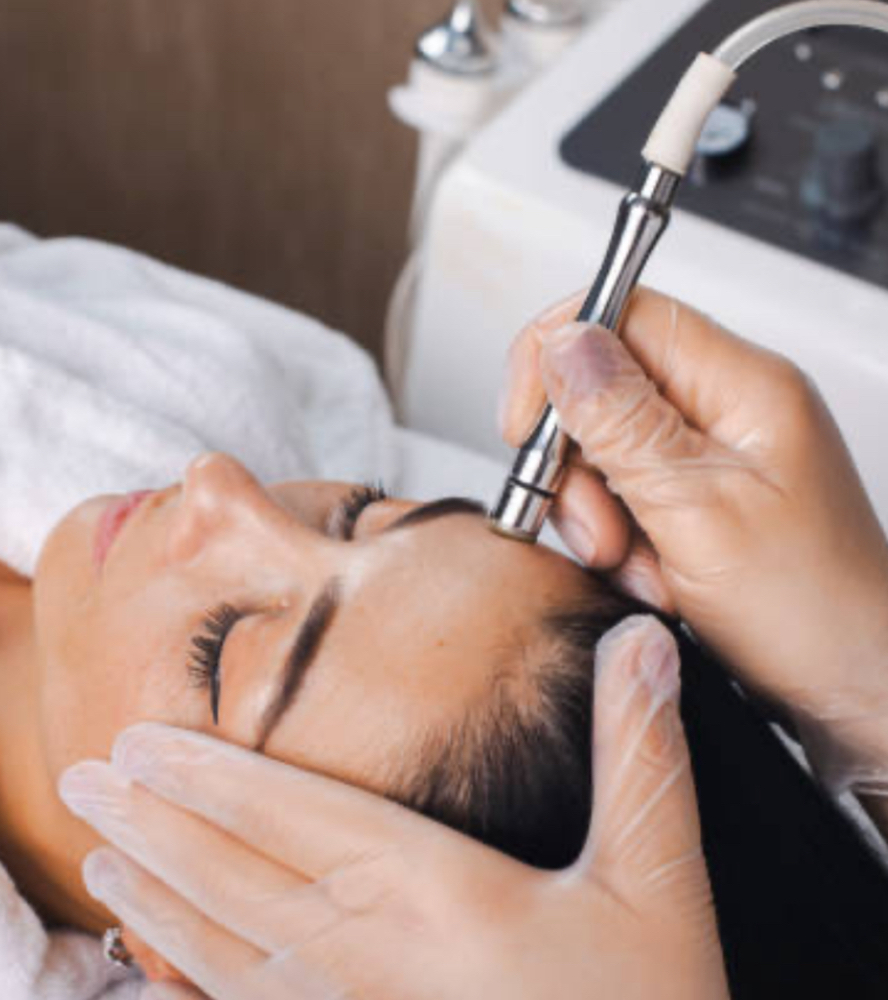 Microdermabrasion ADD-ON