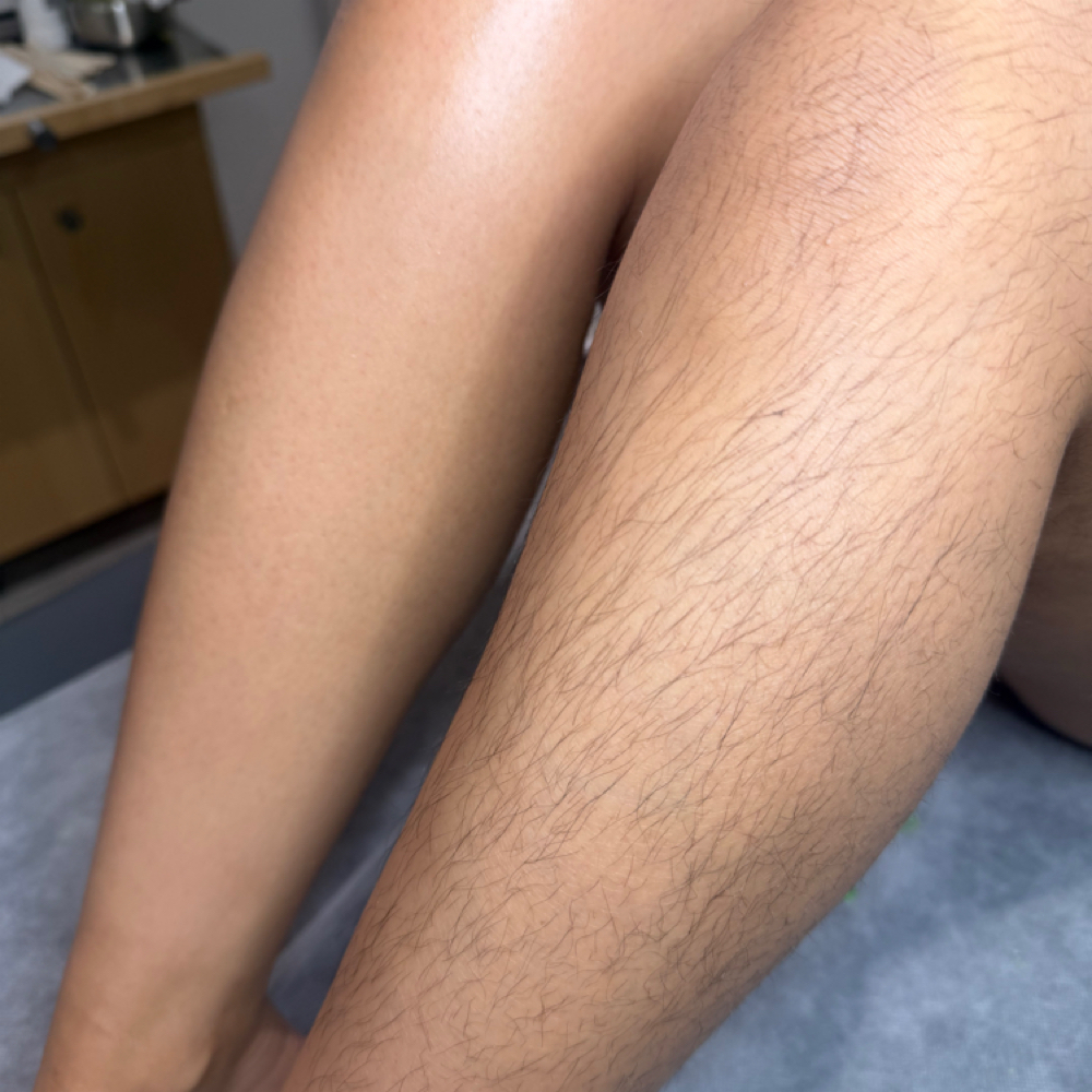 Legs Wax at Vivas Body Waxing in Milwaukee, WI