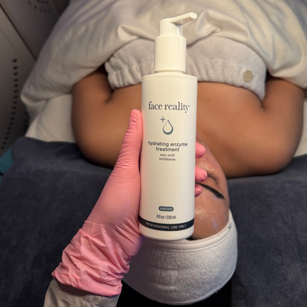 Acne Consultation + First Treatment at skin by gianna v in yorktown, NY