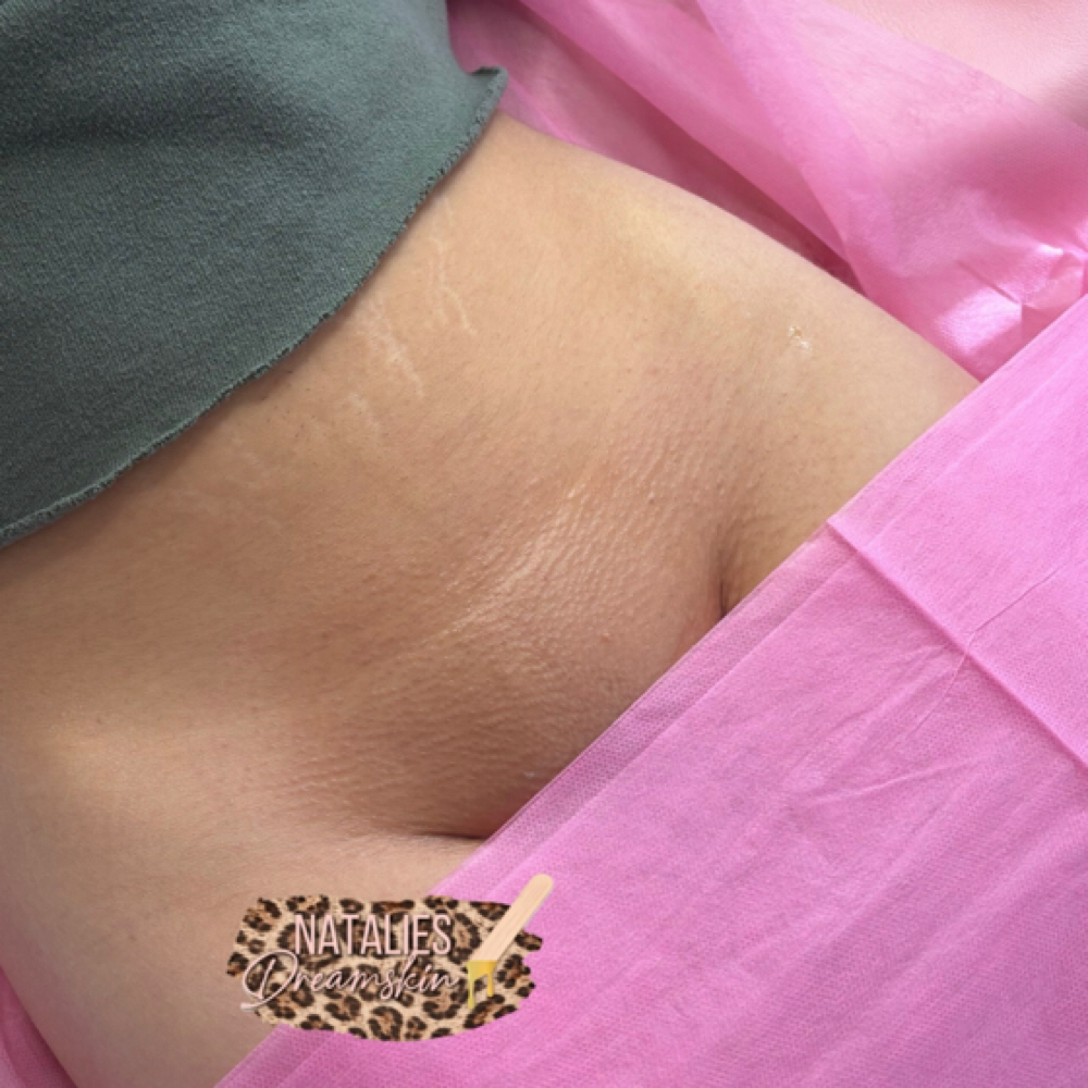 Brazilian Wax at Natalie’s Dream Skin in San Antonio, TX