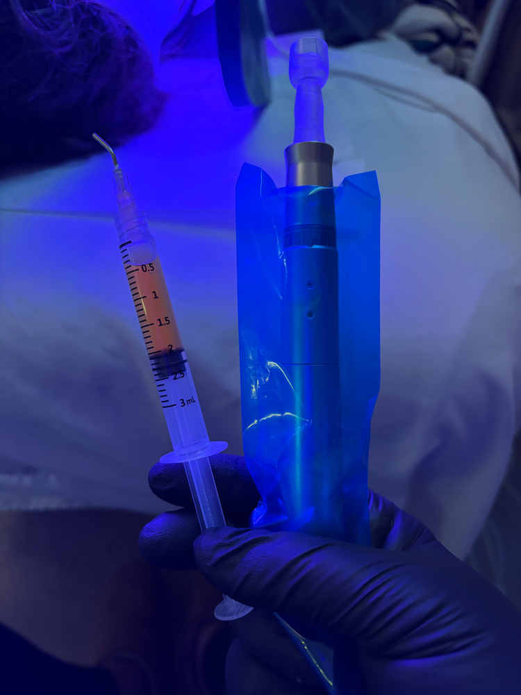 Microchanneling Stem Cell Facial