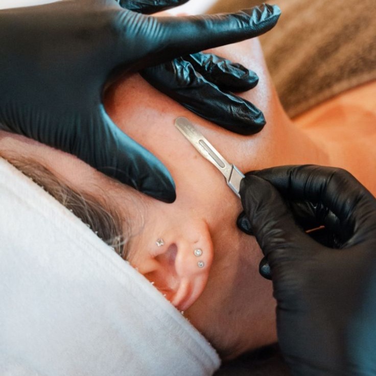 Dermaplane add on at Skin Club Studio in Gilbert, AZ